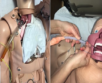 Novel Otolaryngology Simulation for the Management of Emergent Oropharyngeal Hemorrhage