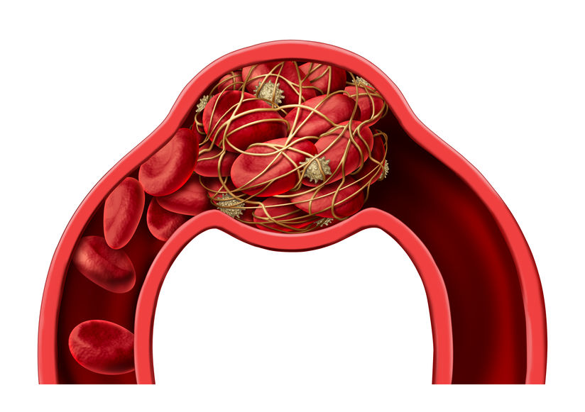 Digital Vessel Thrombosis After Early Cessation of Heparin Therapy Following Reimplantation: Two Case Reports