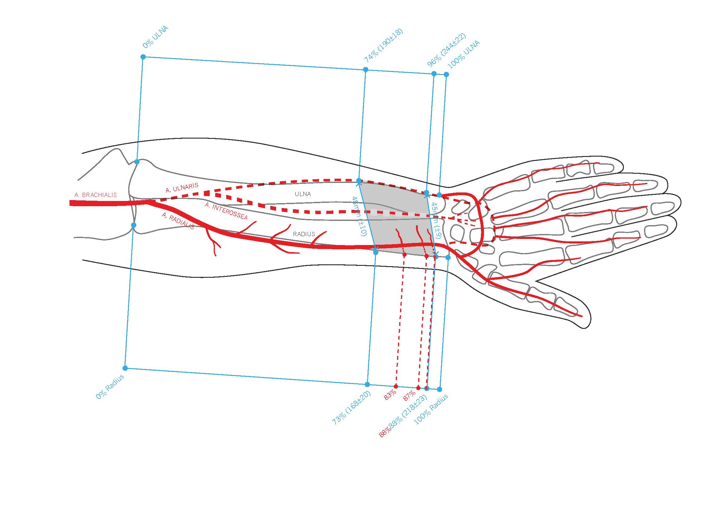 Chimeric Radial Forearm Flap With Pronator Quadratus Muscle for Facial Reanimation: An Anatomical Feasibility Study