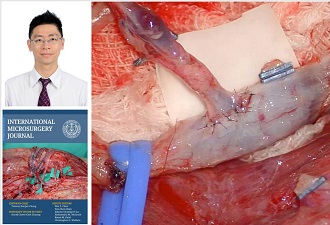 Chang’s Technique of Sequential End-to-Side Microvascular Anastomosis