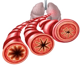 Asthma Medicines and Women’s Sterility